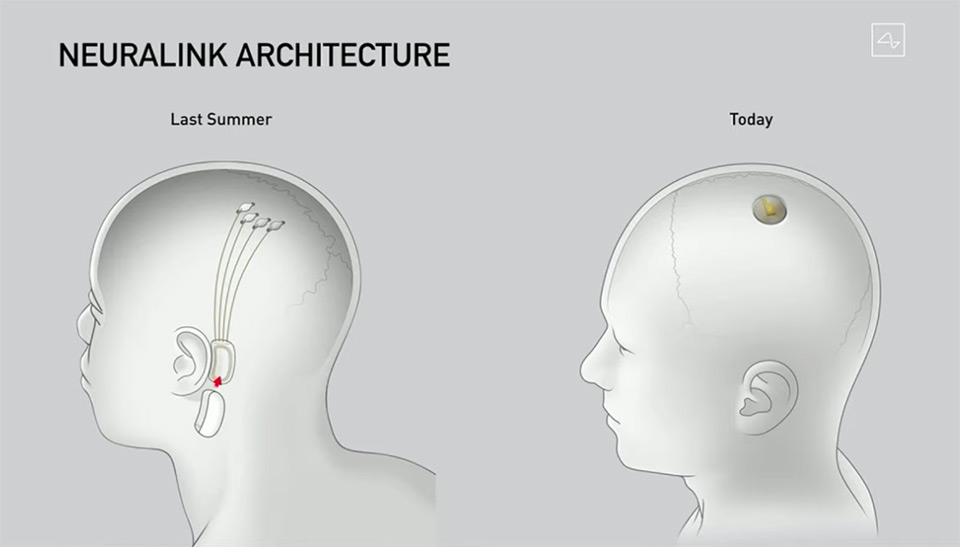 Neuralink: 2019 vs 2020 Neuralink: 2019 vs 2020